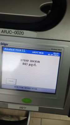 תוצאת הבדיקה  של הנהגת בינשוף. צילום: דוברות המשטרה